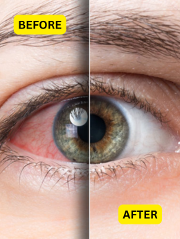 comprehensive-eye-evaluation